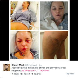 badbitch-empire:  housewifeswag:  Christy Mack released the statement