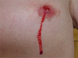 my bleeding nip