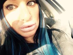 siliconeandmore:  Her lips got bigger 