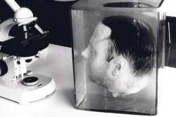crime-time:  Fritz Haarmann’s preserved head. Haarmann known