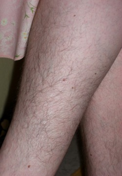 Exquisite hairy legs.