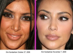 forever90s:  Checkout these Celebs Before & After Cosmetic