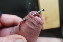 nail through foreskin