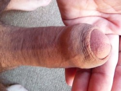 this is my recreated foreskin by stretching, i love having skin