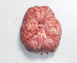 shawnali:  The first time I held a human brain in Anatomy Lab