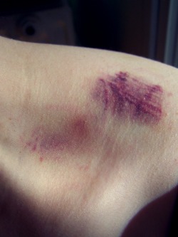 I love bruises. Marks of all kinds, really. The best sex requires
