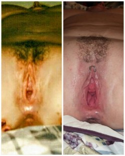 potnecker:  Picture on left is what her pussy looked like when we met. 15 years later of abuse, not that much difference  Amazing difference. Good gape to start, but it&rsquo;s epic now. She looks soooo loose.