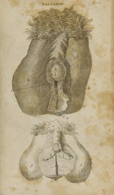 Hermafrodite from Anatomy of the humane body, London, 1713