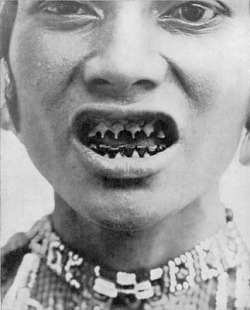 Sharpening teeth is a very painful form of change that the tribes of South Asian women have endured it for many years. It is considered the ultimate form of beauty in those parts. Women Bagobo of Mindanao, the easternmost island of the Philippines, must