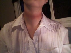 happy-for-hell: cancerfreak69:  So, last night, I was getting ready to go out with my boyfriend to a dance at my school (which was cancelled due to lack of ticket sales) and, I had a nice black vest and a nice white shirt, and my uncle had just came home