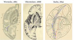 neurosciencestuff:  (Image caption: The first images of the vertical occipital fasciculus, with varying names and abbreviations. Seeing Wernicke’s 1881 drawing from a monkey brain was the “aha” moment that helped the researchers piece the story