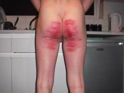master-ferdok:  Did you whip/cane guy4SM’s ass and back to blood after he was caught wanking on camera. This is my ass when I was caught. I was also caned on both hands, cock and balls. It is the only way to make a slave understand that no means no