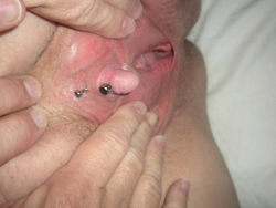 pussymodsgaloreShe has a VCH piercing with a curved barbell. Her clit hood is pulled back to reveal a beautifully prominent and erect clit.