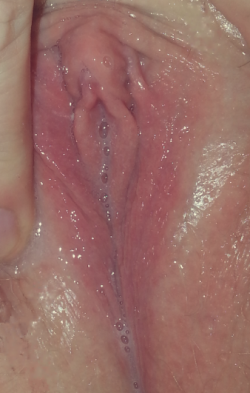 Alice-Is-Wet:   My Poor Clit! She’s So Raw And Swollen! However I Can See The Finish