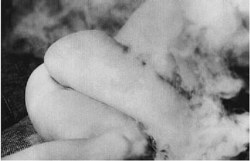David Lynch - De la série ” Nudes and Smoke “