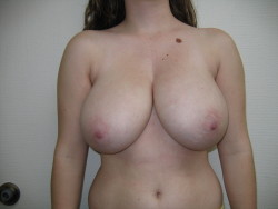 downwith-thethickness:  Nice full breasts