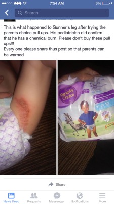 rosexxxblack:  wanderingobsidian:  These are giving babies chemical burns!!!  Please reblog and spread the news to not buy Parent Choice diapers due to them having harsh chemicals that harm cause terrible burns to little ones like this.  So I’ve used