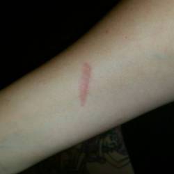 Went to open the gates of hell (the wood stove) and got branded, I guess. #greeeat #allIwantedwasfire #andwarmth #😡😣