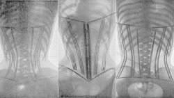 medicalstate:  Le Corset by Ludovic O’Followell. In 1908, a French doctor, Ludovic O’Followell, used x-ray radiography, a medical technology that at the time was still in its infancy, to demonstrate the potential health detriments of the corset. 
