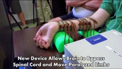 getoutofmyheadcharles:  historyofhyrule:  neurosciencenews:  New Device Allows Brain to Bypass Spinal Cord and Move Paralyzed Limbs Read the full article New Device Allows Brain to Bypass Spinal Cord and Move Paralyzed Limbs at NeuroscienceNews.com.