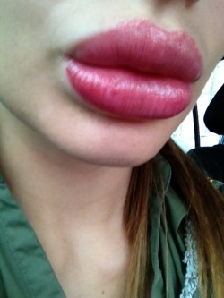 huge fake lips