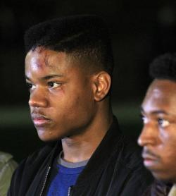 actionables:UPDATE: protesters marched to the spot where Martese Johnsons was arrested while chanting “If we don’t get it, shut it down”. The injuries and the stitches are clearly visible on Martese’s face. Thousands of people, mostly students,