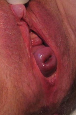 guchman999:  Nice  WOW, check out the combo of that massive hard clit and that prolapsing cervix! I&rsquo;d love to lick her cunt and fuck her with something huge.
