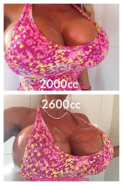 When 2000cc isn&rsquo;t enough for you, and you get 2600cc breast implants, you know you have boobie greed.Fun fact, the average human brain is 1200cc in size. That means each of @marymadisonlove&rsquo;s boobs are more than 2x the size of her brain.