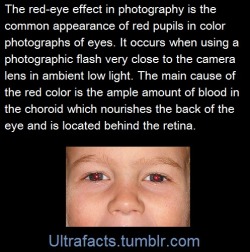 ultrafacts:   Also: If a child is only displaying redeye in one eye in a photograph, you should get them checked, just to be safe, because they could have retinolastoma, a rapidly developing cancer that develops from the immature cells of a retina. (Fact