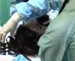putyoutosleepnowzzz:ERIN Part 4Now Erin has been fully anesthetized, the nurses strap the anesthesia mask to Erin’s face so that they can keep her asleep and have their hands free to prep her for her surgery.