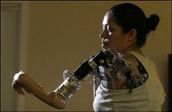 twigwise:  oceanicflight-815:  stardust-and-petrichor:  sister-ragdoll:  lets-hope-we-dont-explode:  hypochondriacdreaming:  cyberneticsarenow:  Claudia Mitchell - first woman to have a bionic arm - a prosthetic limb that she controls with her mind. 