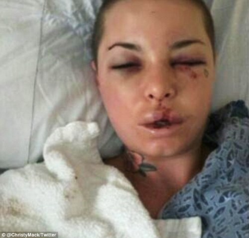 365daysofhorror:  PLEASE reblog this and get the word out. War Machine, an MMA fighter, allegedly brutally beat his ex-girlfriend Christy Mack. He broke 18 bones in her face, ruptured her liver, attempted to rape her, stabbed her with a knife and more.