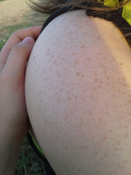 Porn Pics c0ntain:  In love with my girlfriends freckles.