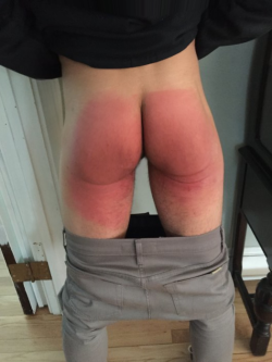 bihan56:  genuinespankings:  Whoever spanked this boy did a good job of guaranteeing he’ll think about being better behaved every time he sits down tomorrow.    hum j adore j adhère 