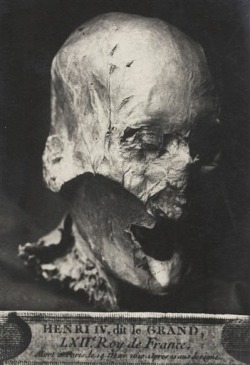 Creepy: King Henry IV’s partially preserved head, which was separated from its body during the French Revolution, when monarchs’ graves were desecrated. You can read more about it here as well.
