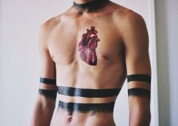 jvmvs:that coronary artery anatomy tho…