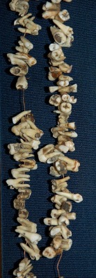One dentist, self-dubbed &ldquo;Painless Parker&rdquo; claimed to have pulled all 357 teeth in this necklace in one day. - From the Dental Museum in Philadelphia, PA