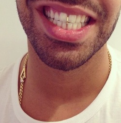 h0odrich:  ovaadosedonconfidence:  Drake’s new gold fill.  game changing 