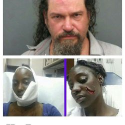 takeprideinyourheritage:  @eye_am_a_god_ -  SLASHED FOR LOOKING AT A WHITE MAN Young Black Goddess  Shakra Simpson of clinton iowa was slashed for looking at a whiteman last night who called Her ‘nigger’ before the attack.  COMING OUT OF A BAR  Shakra