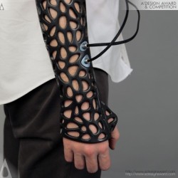 eat-sleep-breathe-cars:  rowed—kill:  laughingsquid:  Osteoid, A 3D-Printed Medical Cast Prototype Featuring an Ultrasound System to Help Heal Bones Faster  I would break an arm for this.