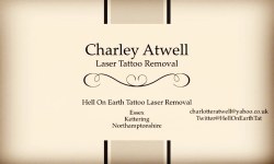 Will be bringing my #lasertattooremoval kit to Essex tomorrow and working from here for next few weeks so if interested in a booking please get in touch! Also work from #kettering #Northamptonshire #essex #tattooremoval #qswitchlaser #lasertattooremoval