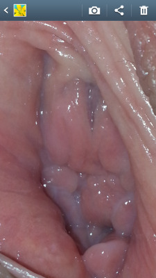 Close up of my wifes dripping wet pussy Looks awesome, thanks :P