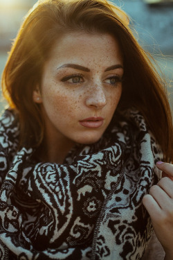  Freckles | © | AOI 