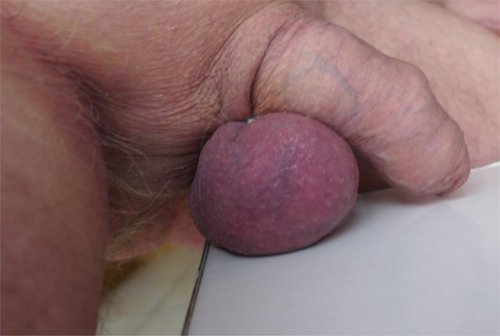 Porn Pics my banded blue balls