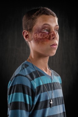 tonytobar:  What if verbal abuse left the same scars as physical abuse? Would it be taken more seriously? That’s what photographer Richard Johnson hopes to accomplish with his new photo project, “Weapons of Choice.” The series uses a makeup artist