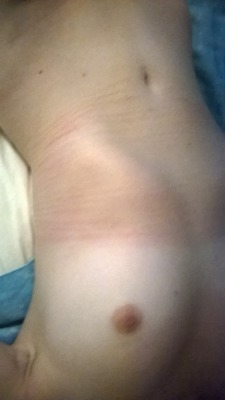 My rope marks