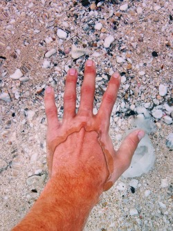 lindsayolohan:  stunningpicture:  Very clear water.  I thought the skin was peeling   Sweet!