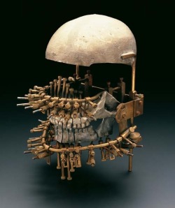 Model used for studying and treatment of jaw fractures. From the Institute of Dentistry, University of Zurich, 1900 - 1930