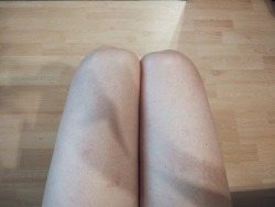 After shaving my legs became sausages :D
