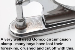 circisbest:  circumcisedperfection: circ-n-squeal:  Literally hundreds of baby boys squealed in the Circumstraint because of this veteran Gomco clamp.  So cruel but true   Few men could tell you what this is called but millions were beaten by it.